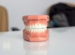 Plastic gebitsmodel met melktanden op een witte tafel, gebruikt voor uitleg over kindergebit